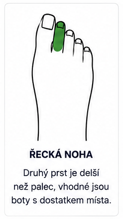 Řecká noha u dítěte